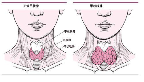 白癜风也有并发症？这5种并发症，白癜风患者你们过招了吗？